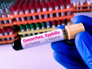 Test tube with Gonorrhea and Syphilis written on it for STI blog